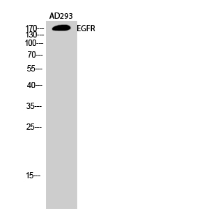Anti-EGFR Antibody Anti-EGFR Antibody