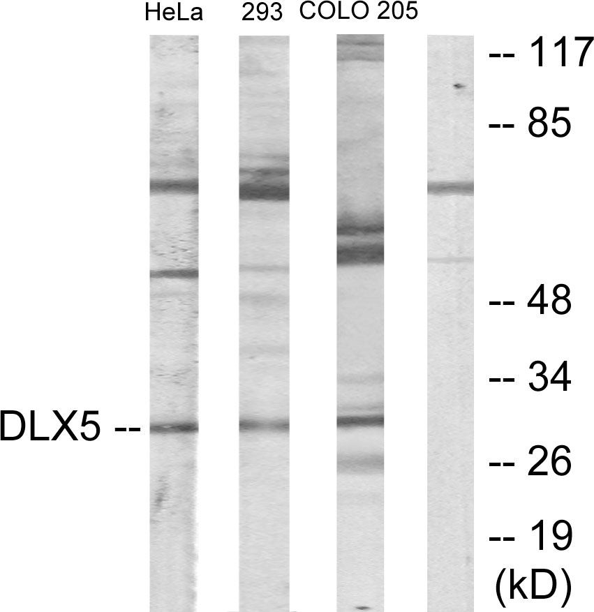Anti-DLX5 Antibody - Identical to Abcam (ab64827)