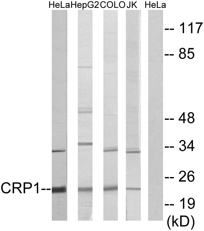 Anti-CRP1 Antibody - Identical to Abcam (ab70010)