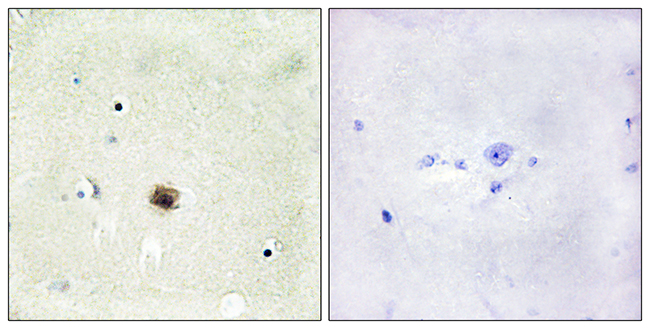 Anti-CRP1 Antibody - Identical to Abcam (ab70010) Anti-CRP1 Antibody - Identical to Abcam (ab70010)