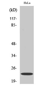 Anti-CRP1 Antibody - Identical to Abcam (ab70010) Anti-CRP1 Antibody - Identical to Abcam (ab70010)