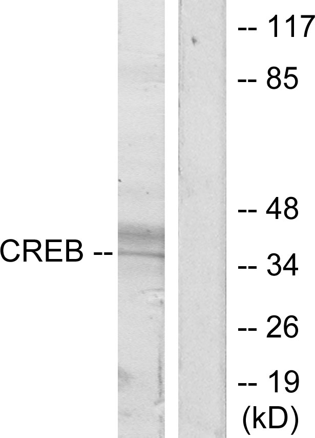 Anti-CREB Antibody