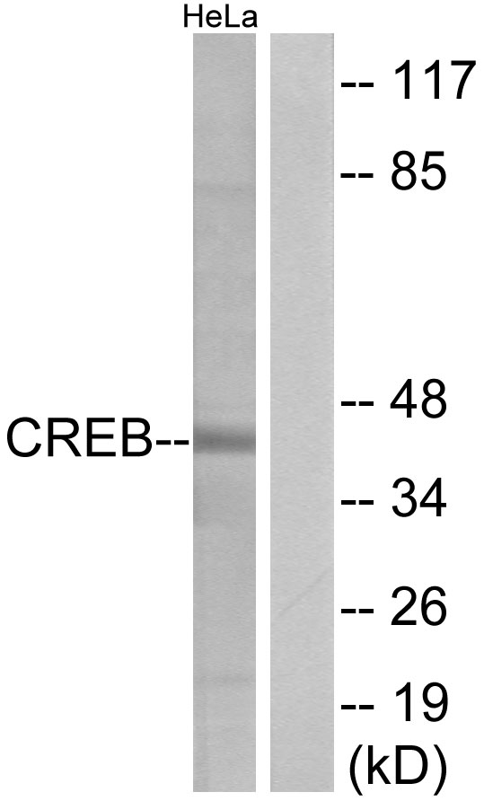 Anti-CREB Antibody