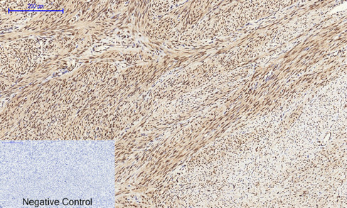 Anti-CREB Antibody Anti-CREB Antibody