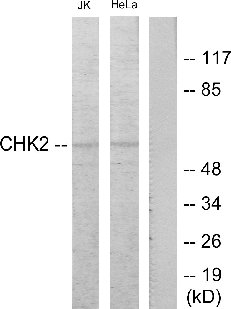 Anti-Chk2 Antibody