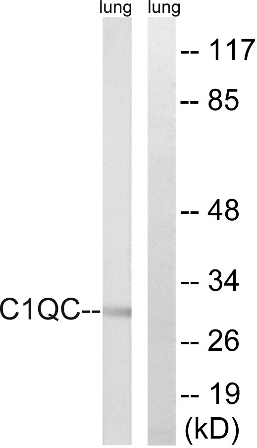 Anti-C1QC Antibody Anti-C1QC Antibody