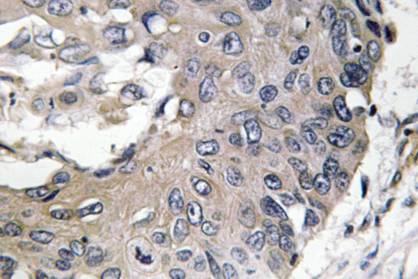 Anti-ApoE Antibody Anti-ApoE Antibody