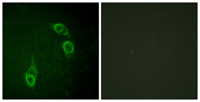 Anti-APC1 Antibody
