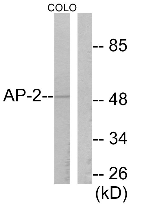 Anti-AP-2 Antibody