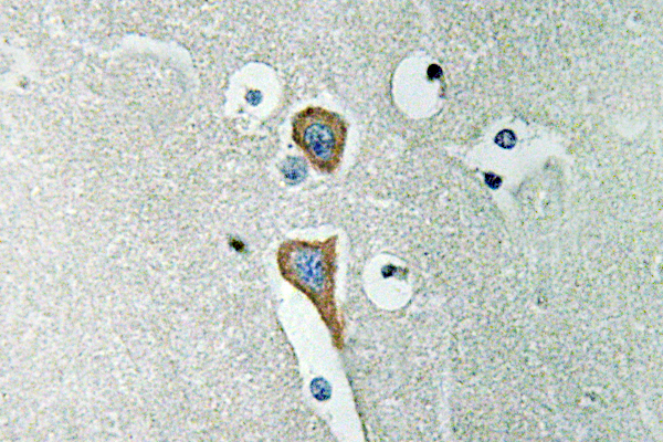 Anti-AChE Antibody Anti-AChE Antibody