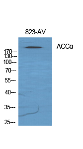 Anti-ACC1 Antibody Anti-ACC1 Antibody