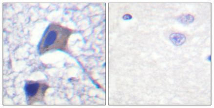 Anti-ACC1 Antibody Anti-ACC1 Antibody