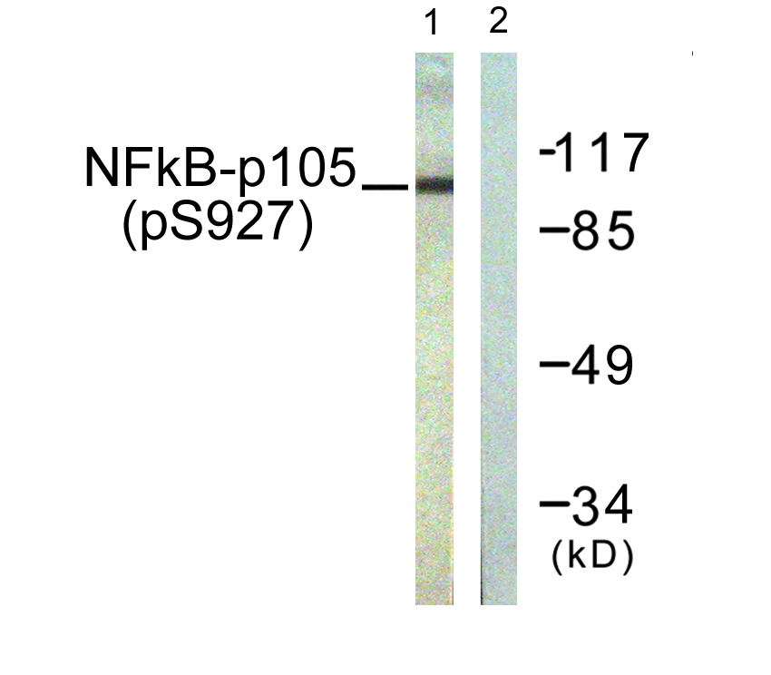 Anti-NF kappa B p105 / p50 (phospho Ser927) Antibody