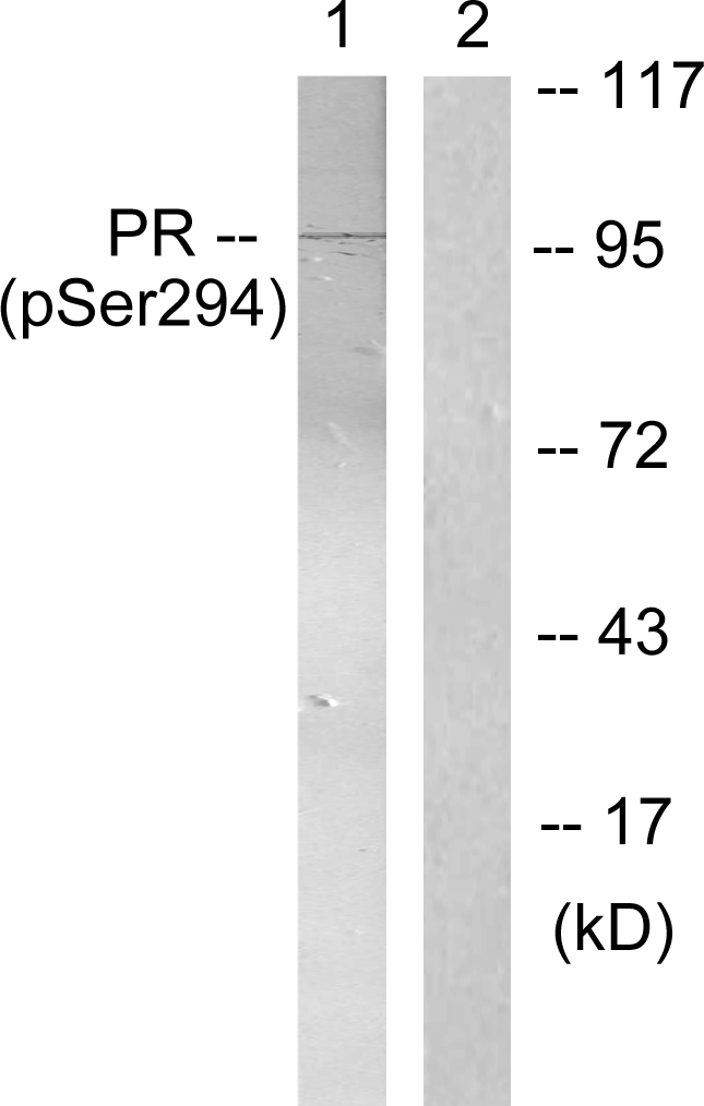 Anti-Progesterone Receptor (phospho Ser294) Antibody - Identical to Abcam (ab61785)