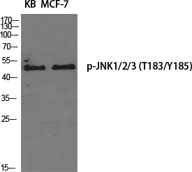 Anti-JNK1 + JNK2 + JNK3 (phospho Thr183+Tyr185) Antibody Anti-JNK1 + JNK2 + JNK3 (phospho Thr183+Tyr185) Antibody