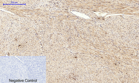 Anti-JNK1 + JNK2 + JNK3 (phospho Thr183+Tyr185) Antibody Anti-JNK1 + JNK2 + JNK3 (phospho Thr183+Tyr185) Antibody