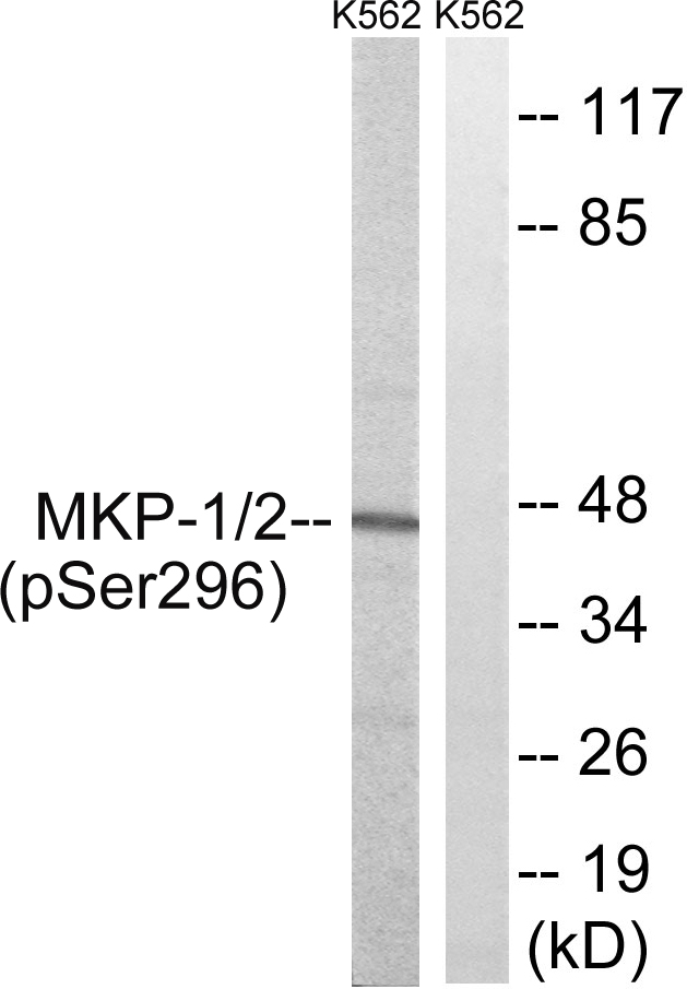 Anti-MKP1 + MKP2 (phospho Ser296 + Ser318) Antibody