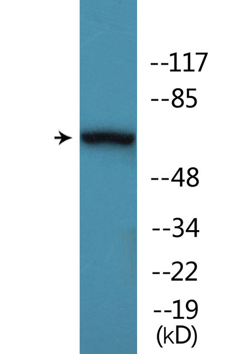 Anti-AKT1 + AKT3 (phospho Tyr437 + Tyr434) Antibody Anti-AKT1 + AKT3 (phospho Tyr437 + Tyr434) Antibody