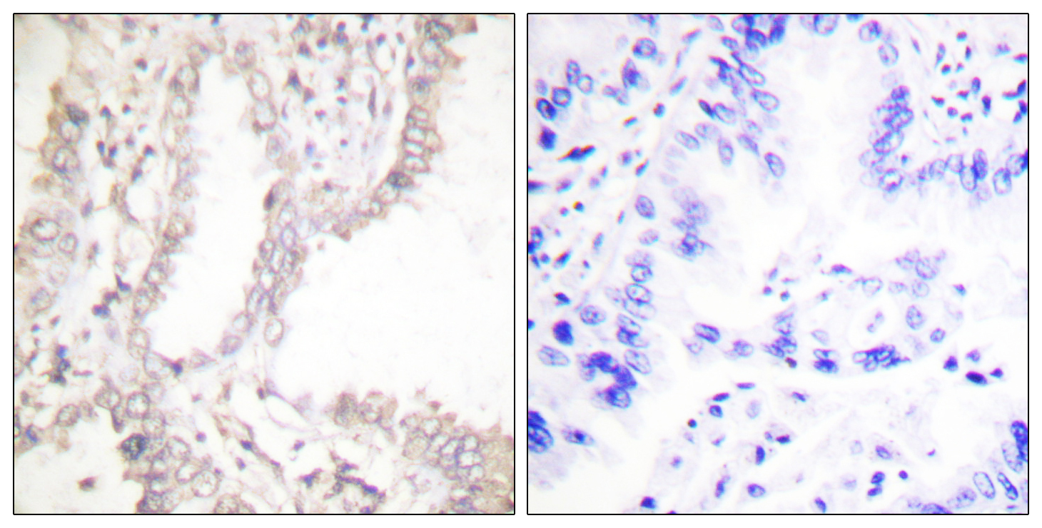Anti-Prostate Apoptosis Response protein-4 Antibody Anti-Prostate Apoptosis Response protein-4 Antibody