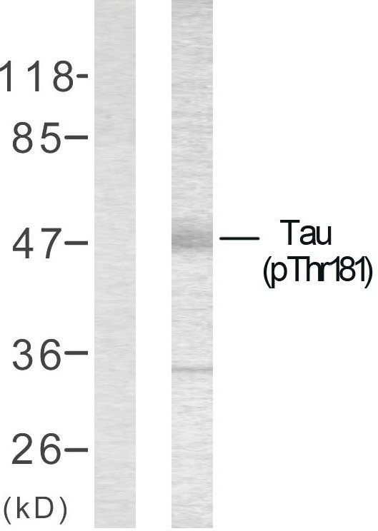 Anti-Tau (phospho Thr181) Antibody - Identical to Abcam (ab75679)