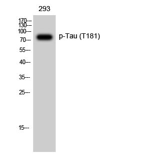 Anti-Tau (phospho Thr181) Antibody - Identical to Abcam (ab75679) Anti-Tau (phospho Thr181) Antibody - Identical to Abcam (ab75679)