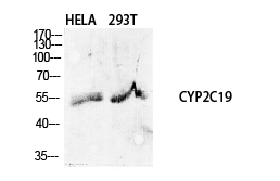 Anti-Cytochrome P450 2C19 Antibody Anti-Cytochrome P450 2C19 Antibody