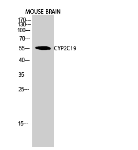 Anti-Cytochrome P450 2C19 Antibody Anti-Cytochrome P450 2C19 Antibody