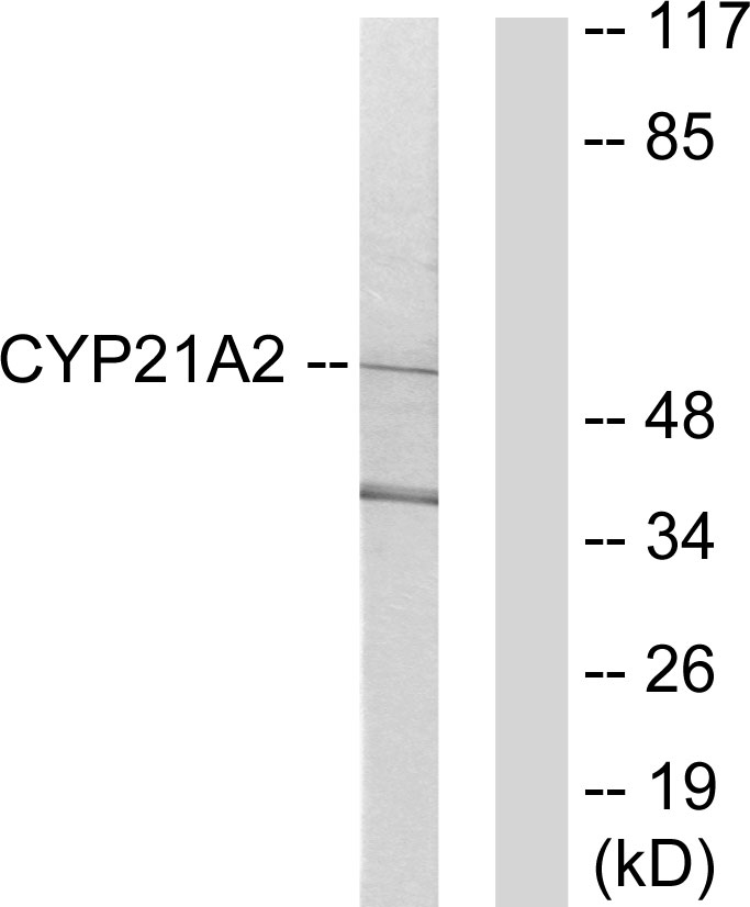 Anti-Cytochrome P450 21A2 Antibody - Identical to Abcam (ab64887)