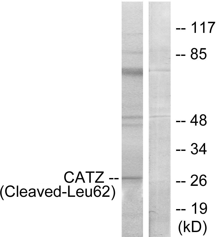 Anti-CATZ (cleaved Leu62) Antibody
