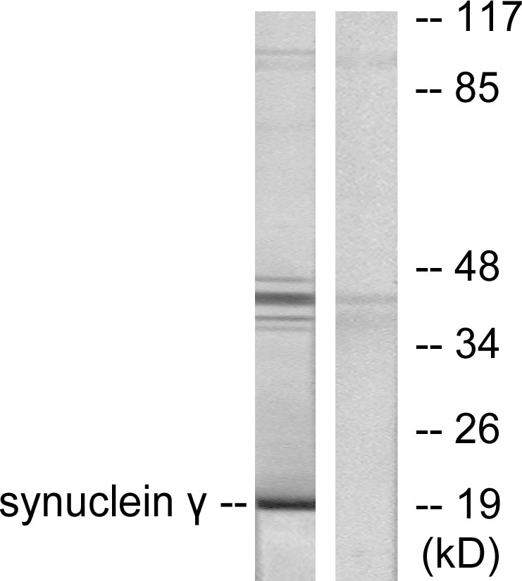 Anti-Synuclein gamma Antibody - Identical to Abcam (ab55424)