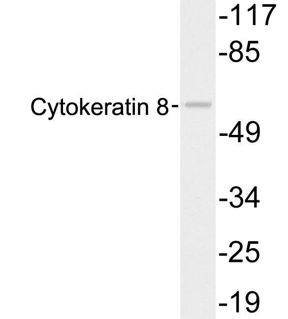 Anti-Cytokeratin 8 Antibody