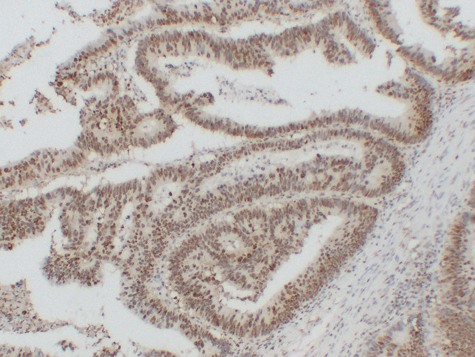 Anti-Nucleophosmin Antibody [ABT-NPM]
