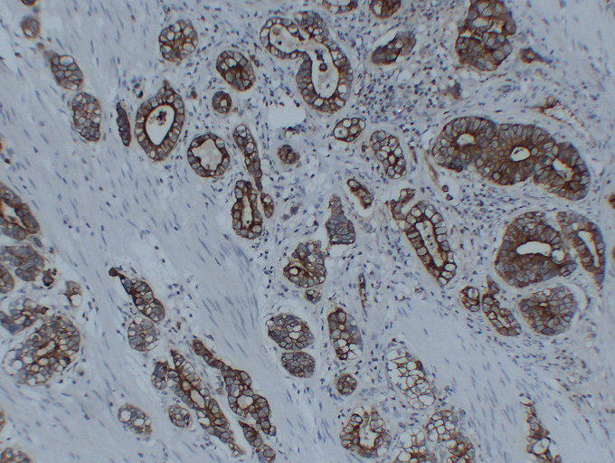 Anti-Cytokeratin 8 Antibody [ABT-CK8]