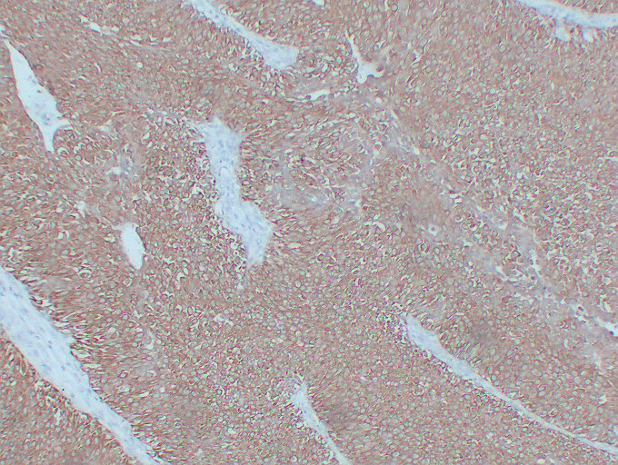 Anti-Cytokeratin 7 Antibody [ABT-CK7]