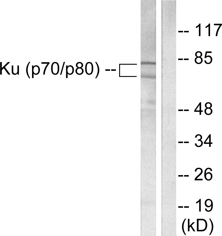 Anti-Ku70 + Ku80 Antibody - Identical to Abcam (ab53126)