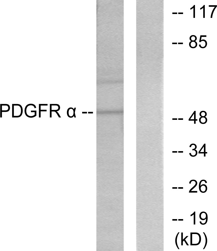 Anti-Peripherin Antibody - Identical to Abcam (ab53051)
