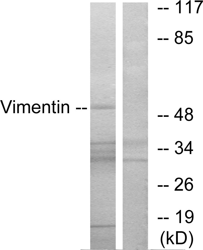 Anti-Vimentin Antibody