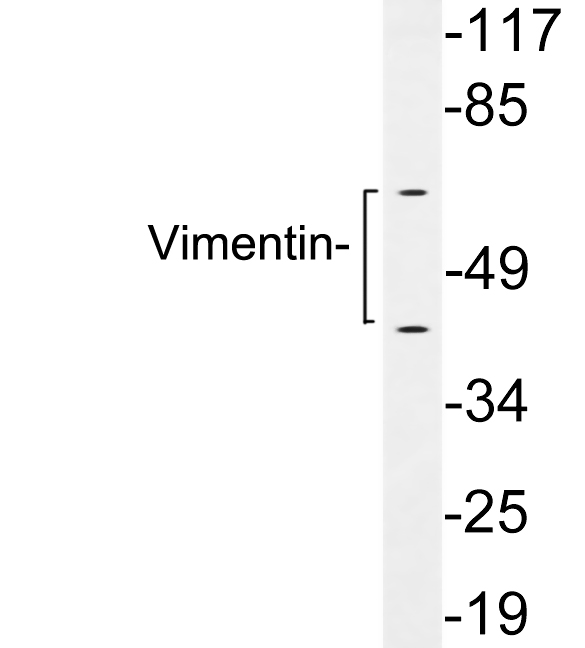 Anti-Vimentin Antibody