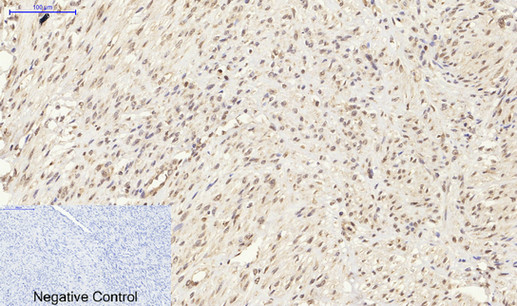 Anti-Synapsin Antibody Anti-Synapsin Antibody