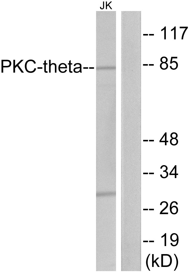 Anti-PKC thet Antibody