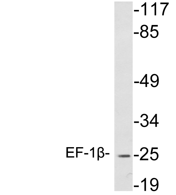 Anti-EF-1beta Antibody