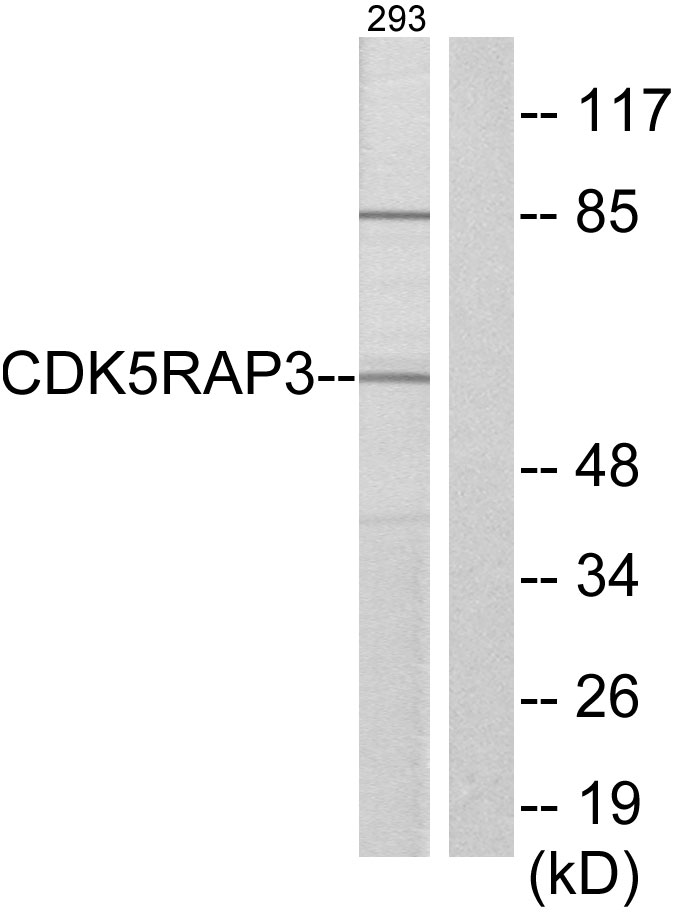 Anti-CDK5RAP3 Antibody