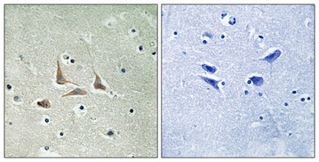 Anti-CDK5RAP3 Antibody Anti-CDK5RAP3 Antibody