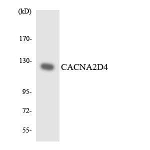 Anti-CACNA2D4 Antibody