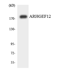 Anti-ARHGEF12 Antibody