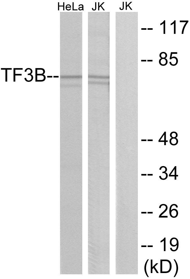 Anti-TF3B Antibody
