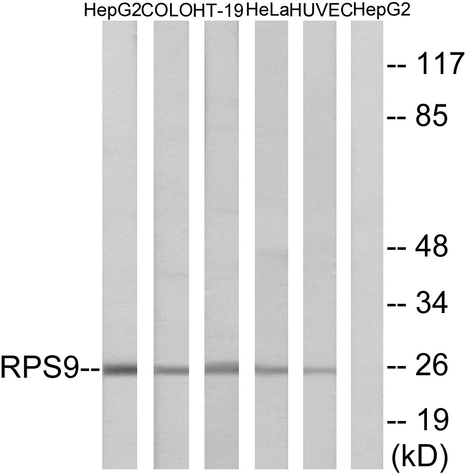 Anti-RPS9 Antibody - Identical to Abcam (ab74711)