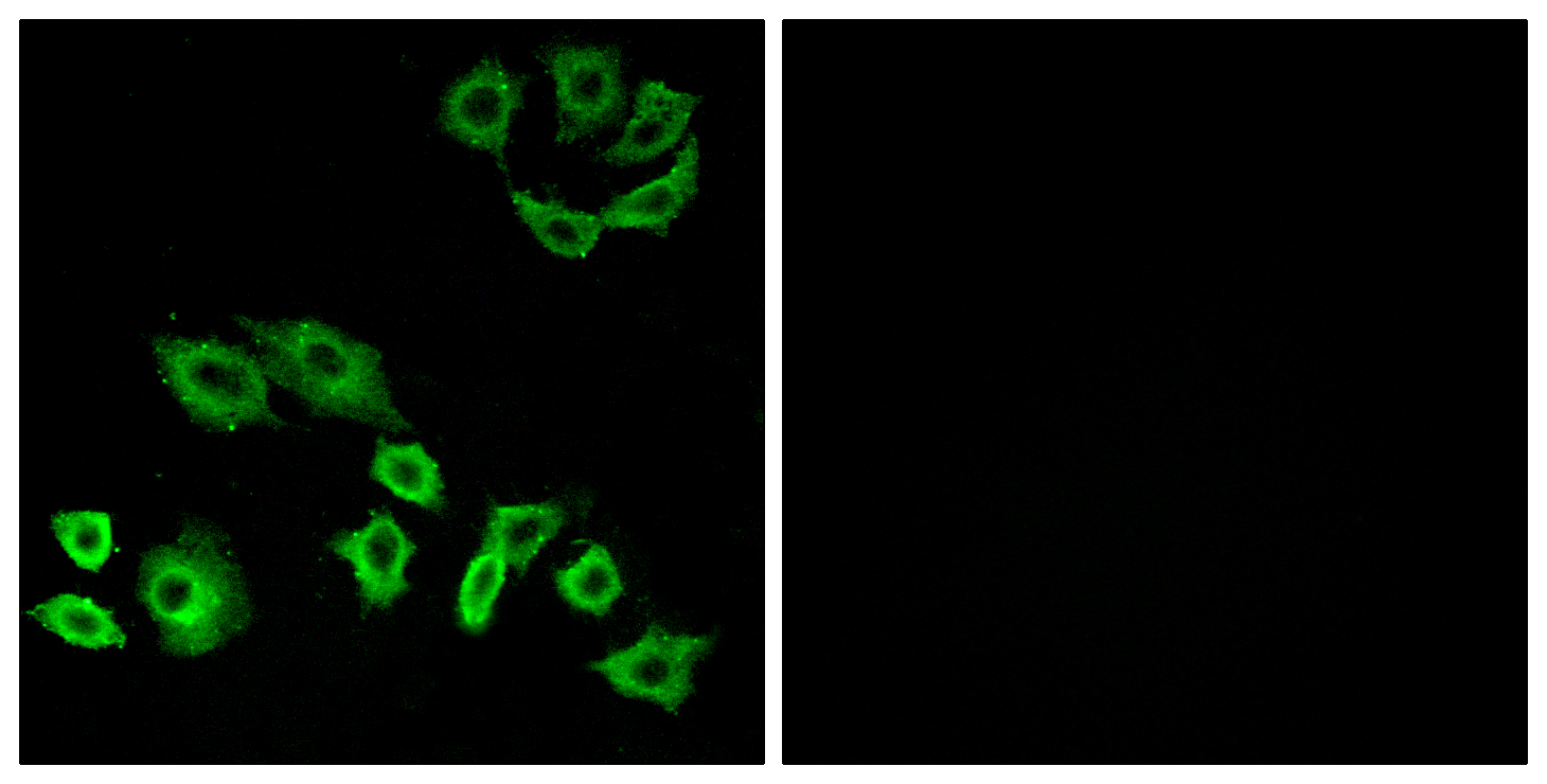 Anti-RhoH Antibody - Identical to Abcam (ab118507)