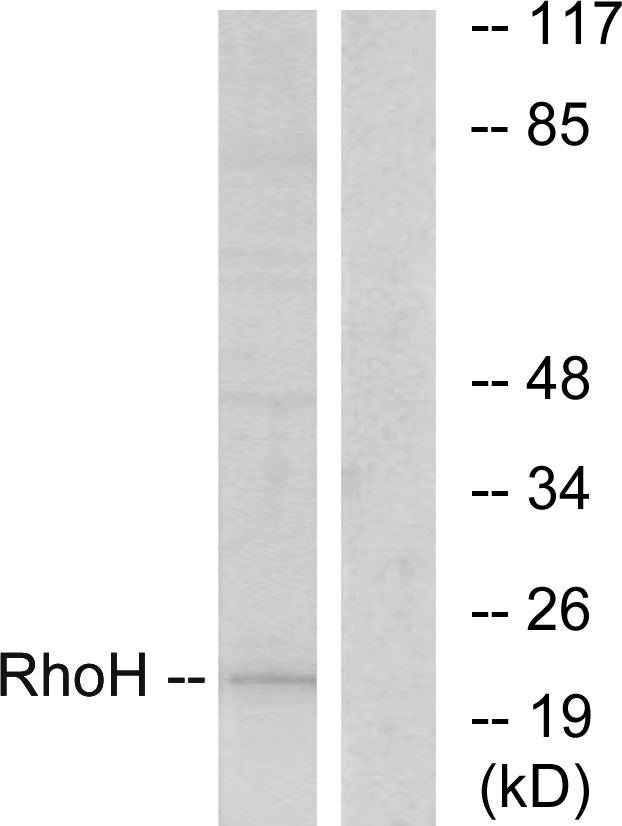 Anti-RhoH Antibody - Identical to Abcam (ab118507) Anti-RhoH Antibody - Identical to Abcam (ab118507)