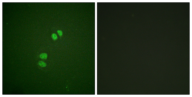 Anti-PLK1 Antibody